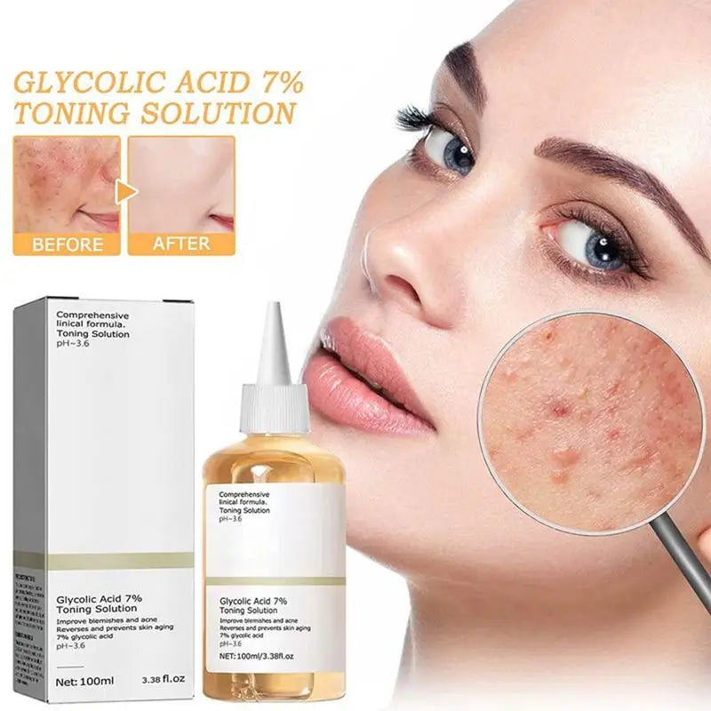 Glycolic Acid 7% Toner Remove Acne Fade Acne Marks Improve Skin Hydrating Moisturize Whitening Toning Skin Care Original