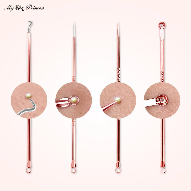 Rose Gold 4pcs/set Blackhead Comedone Acne Pimple Belmish Extractor Vacuum Blackhead Remover Tool Spoon for Face Skin Care Tool