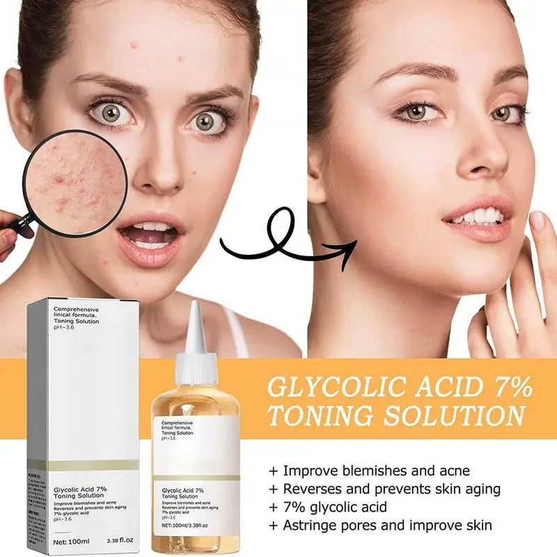 Glycolic Acid 7% Toner Remove Acne Fade Acne Marks Improve Skin Hydrating Moisturize Whitening Toning Skin Care Original