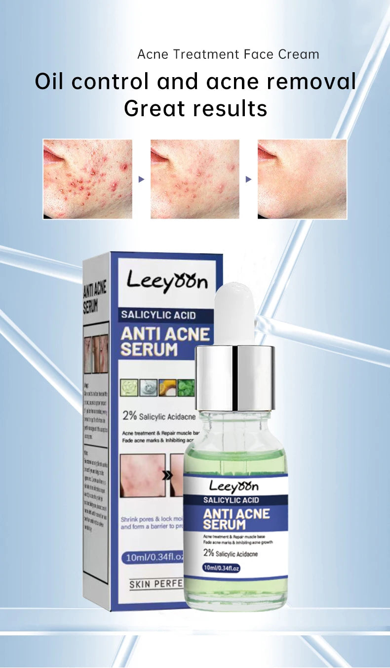 Effective Acne Treatment Repair Spots Salicylic Acid Acne Removal Serum Moisturizing Oil Control Shrink Pore Skin Care