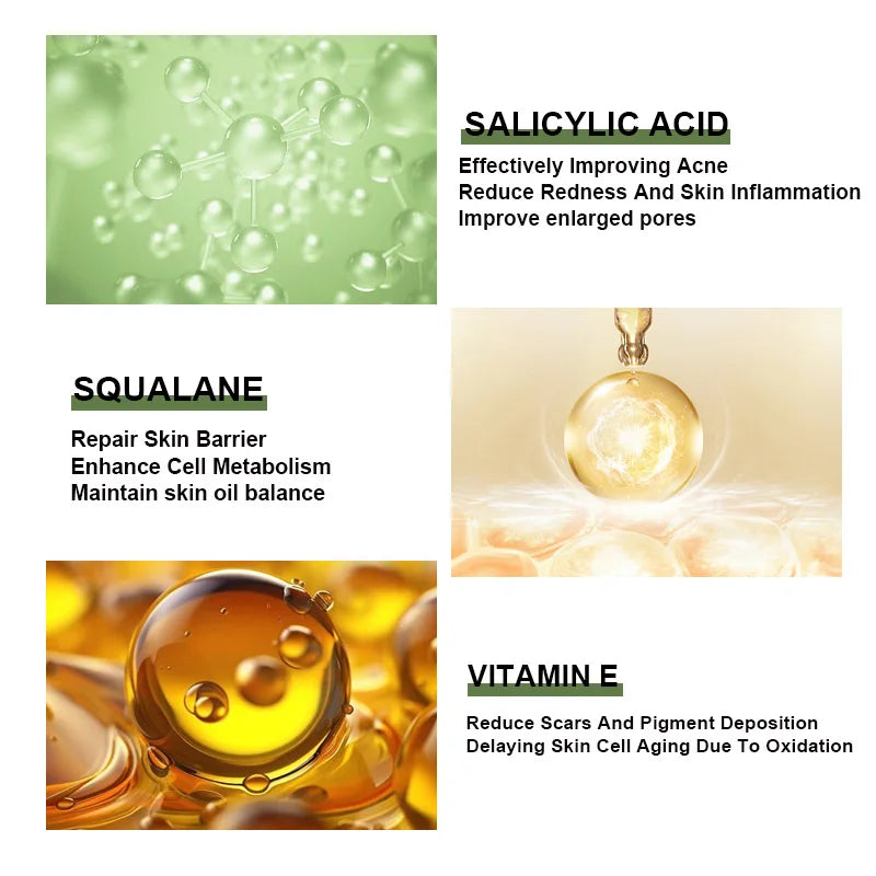 Salicylic Acid Acne Removing Serum Squalane Shrink Pores Facial Essence Vitamin E Moisturizing Skincare Products