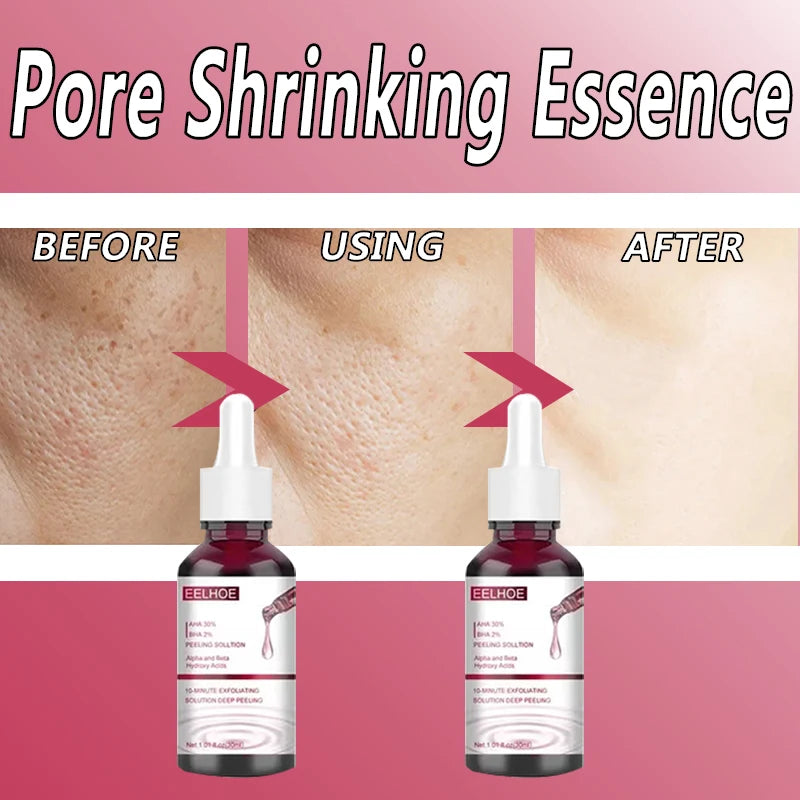 Pore Shrinking Serum Smooth Pores Whitening Moisturizing Anti Aging Brighten Skin Care Product Salicylic Fruit Acid Essence