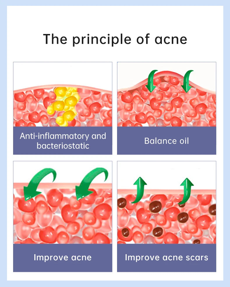 Effective Acne Treatment Repair Spots Salicylic Acid Acne Removal Serum Moisturizing Oil Control Shrink Pore Skin Care